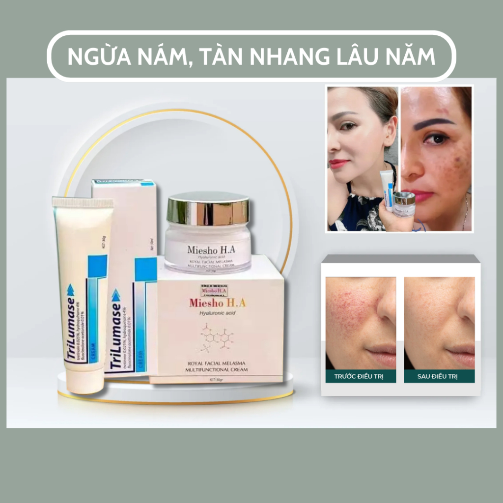 Combo giảm nám tàn nhang MIESHO H.A & TR.ILUMASE - Phục hồi nám tàn nhang MIESHO H.A & TR.ILUMASE - QUINN BEAUTY STORE