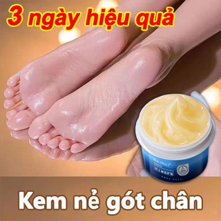 Kem nẻ vaseline Kem nẻ gót chân 40g Chống khô nứt nẻ tay chân á sừng bong da nứt gót chân dưỡng ẩm sửa chữa da khô