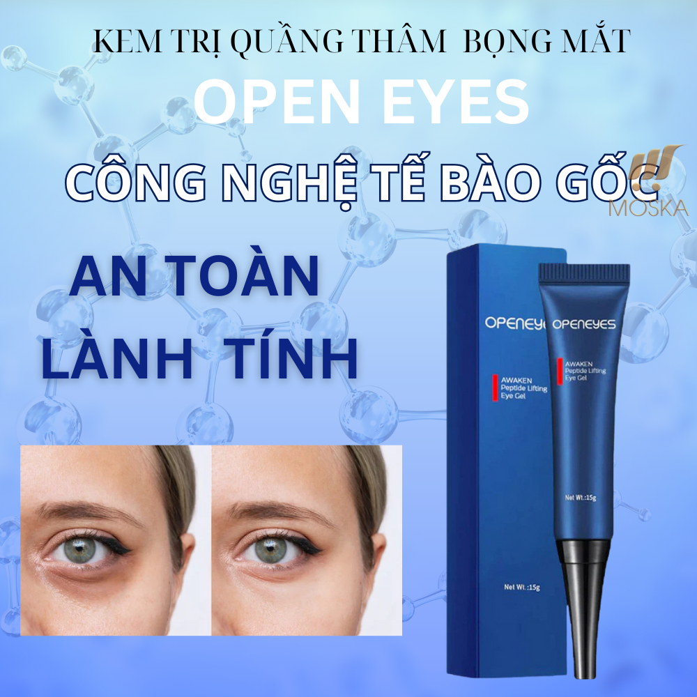 Kem Openeyes Xoá Tan Bọng Mắt, Xoá Sạch Thâm Quầng Mắt - Kem Dưỡng Mắt Openeyes Mỹ 15gr Trẻ Hoá Đôi Mắt Tuổi 20 | Moska