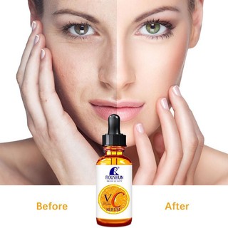 Serum vitamin C tươi