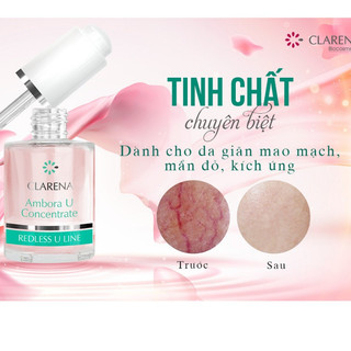   CHÍNH HÃNG  CLARENA Ambora U Concentrate Tinh Chất Phục Hồi Da Giãn Mao Mạch Kích Ứng Mẫn Đỏ 
