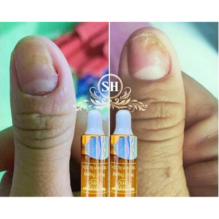 4 chai dưỡng móng SH ( hàng sản xuất tại xưởng)