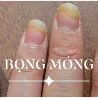 4 chai dưỡng móng SH ( hàng sản xuất tại xưởng)
