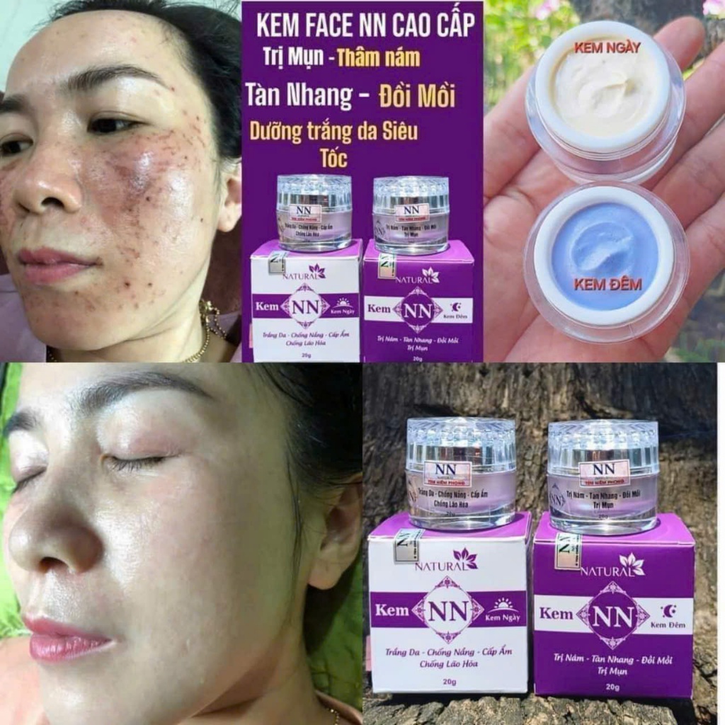 Kem face NN chính hãng mẫu mới 50g