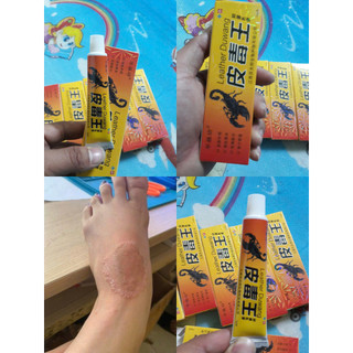 [bọ cạp vàng] hỗ trợ N.gứ.a, N.ấ..m Ng.ứ..a, M.ề Đ..ay Và T-ổ Đ-ỉa an toàn cho mọi loại da kem bôi