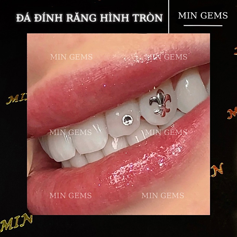 Đá đính răng hình tròn , đá gems đính răng Min Gems( có hoả tốc Hà Nội )