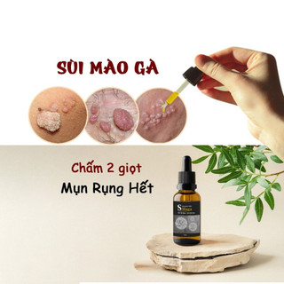  SMAGA giúp loại bỏ sùi mào gà gai sinh duc hạt ngọc dv sau 5 ngày sử dụng an toàn hiệu quả nhanh   che tên   