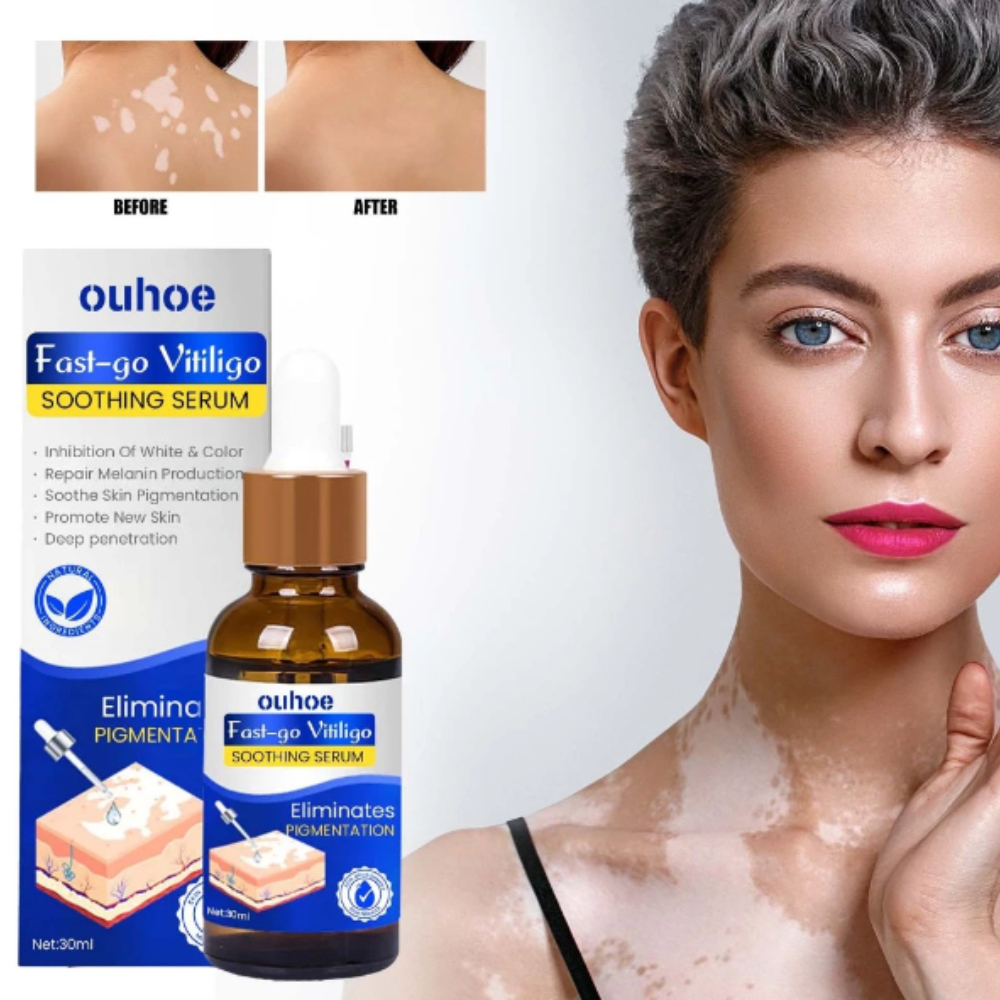 Tinh chất bôi lang ben, bạch biến OUHOE - Serum OUHOE hỗ trợ làm đều màu da, loại bỏ hắc lào, đốm trắng,...