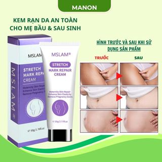Kem Rạn Mslam Kem Dạn Da Sau Sinh Hỗ Trợ Giảm Rạn Da Săn Chắc Da Sau Sinh Cho Da Mịn Màng
