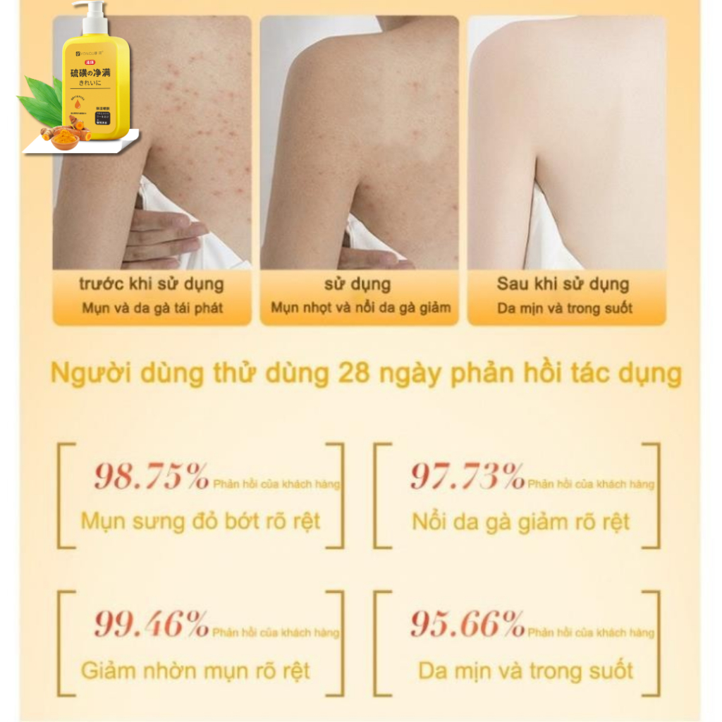 Sữa tắm nghệ đỏ YONGU cải thiện mụn, viêm nang lông - Cải thiện da vẩy rắn, thải độc tố làm trắng sáng da - QUINN BEAUTY