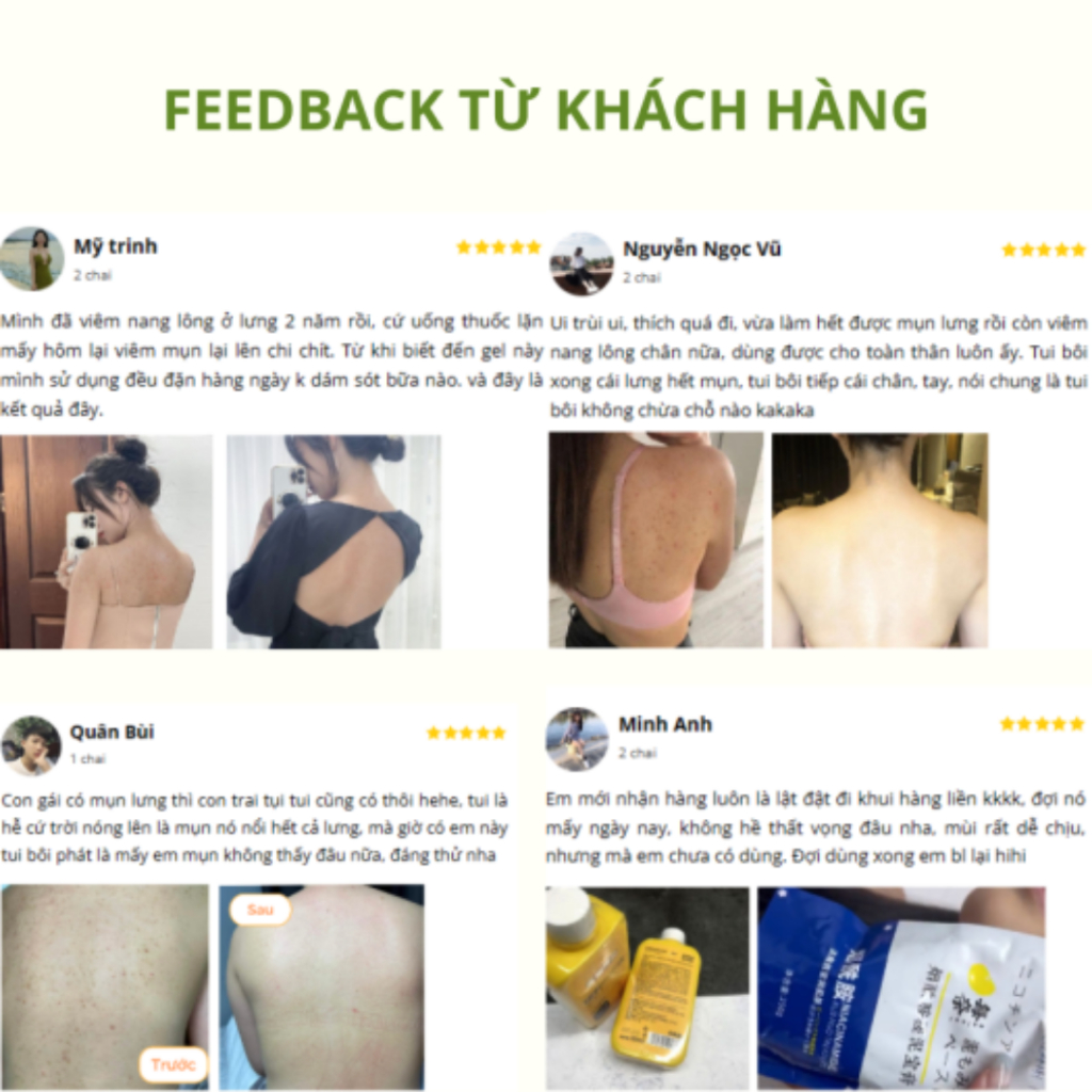 Sữa tắm nghệ đỏ YONGU cải thiện mụn, viêm nang lông - Cải thiện da vẩy rắn, thải độc tố làm trắng sáng da - QUINN BEAUTY