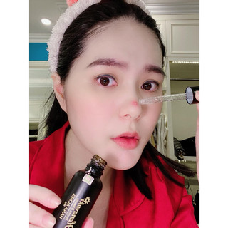 Serum Mụn Hanayuki Loại Lớn 30g Màu Đen