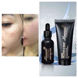 Serum Nám Hanayuki Melasma Loại Lớn Màu Đen 30g