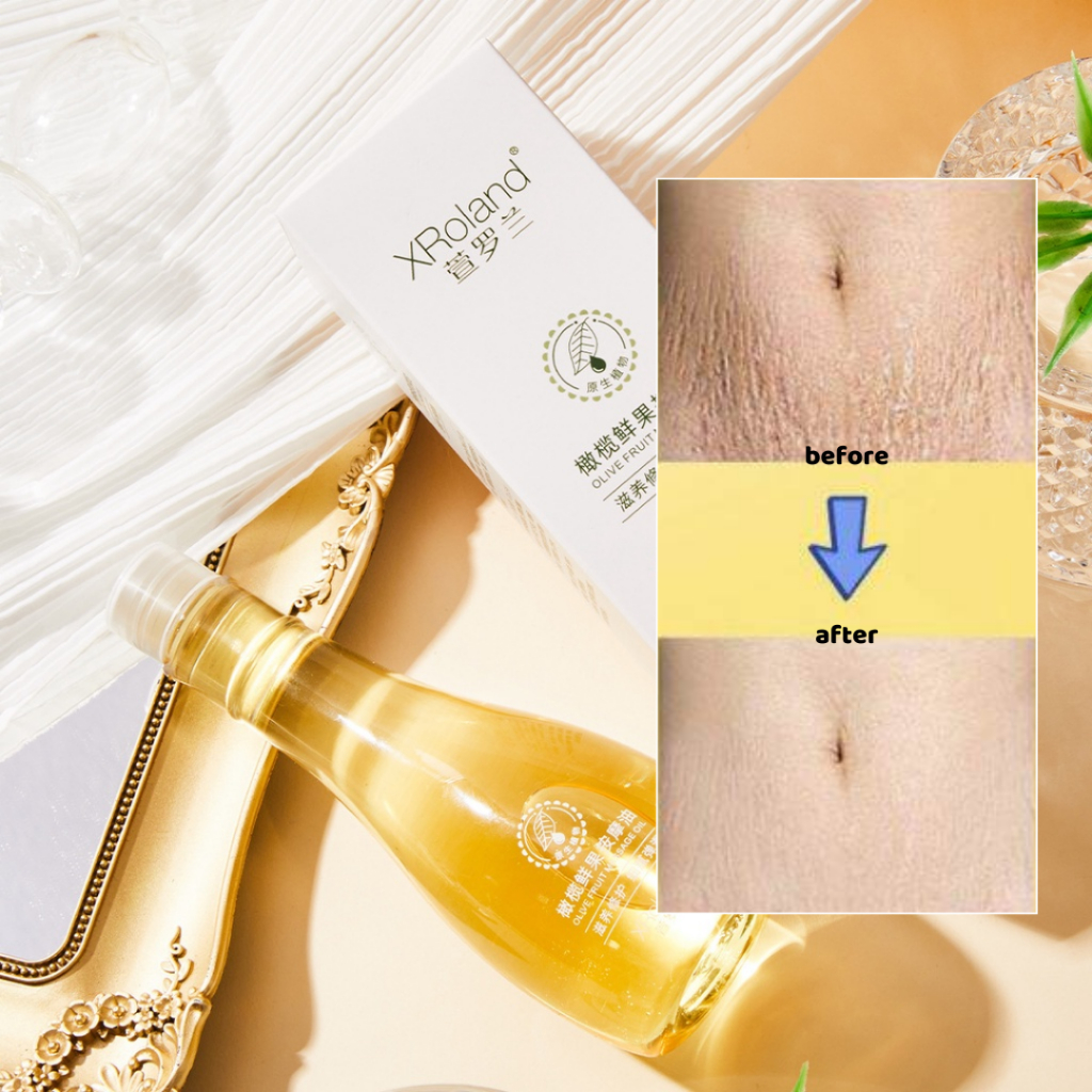 Tinh dầu Oliu Xroland giúp cải thiện rạn da, hỗ trợ da săn chắc đàn hồi cho các mẹ bầu, làm mờ vết nhăn - QUINN BEAUTY