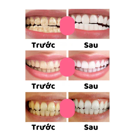 Viên kem đánh răng HAPIKO MAIGOOLE - Kem đánh răng dạng viên sủi bọt MAIGOOLE làm sạch, thơm miệng nhanh chóng hiệu quả