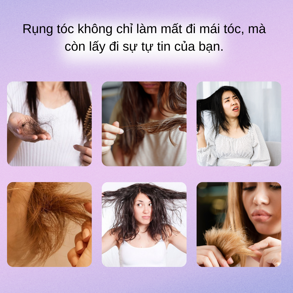 Tinh Chất Serum Giúp Mọc Tóc SE Compliment Hỗ Trợ Ngăn Ngừa Rụng Tóc, Kích Thích Mọc Tóc, Tăng Độ Đàn Hồi Tóc | BK INNO