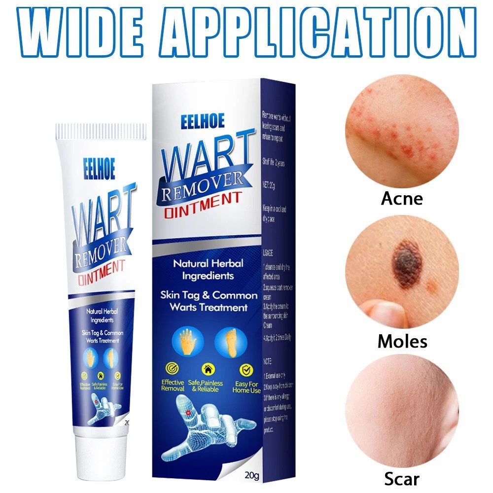 Kem Wart Remover Ointment loại bỏ mụn cóc mụn thịt nốt ruồi trên da từ thảo dược thiên nhiên cao cấp không gây sẹo