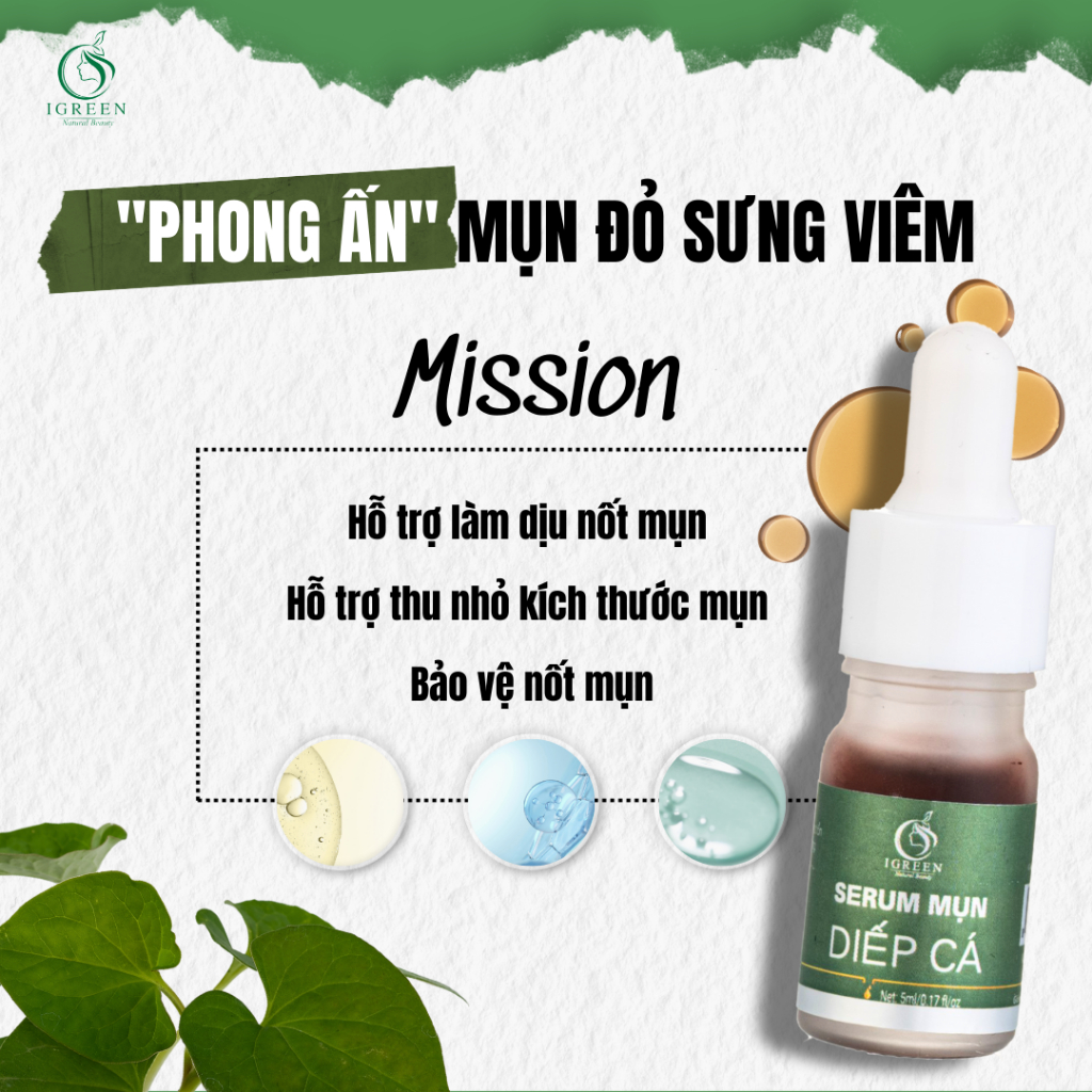 Serum Mụn Diếp Cá IGREEN 5ml - Giảm mụn, giảm thâm, se khít lỗ chân lông, dưỡng da | BigBuy360 - bigbuy360.vn