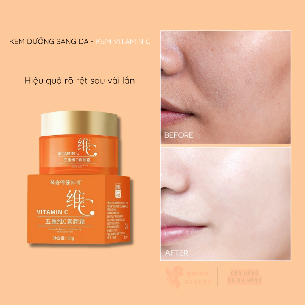 Kem Dưỡng Làm Sáng Da Vitamin C - Kem Lười Vitamin C Giúp Đều Màu, Trẻ Hóa Da, Chống Nắng SPF 30 PA+++