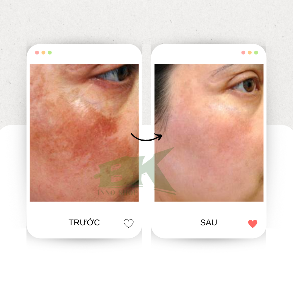 Kem Trắng Da Mặt Beauty Visage White Nga 45ML, Hỗ Trợ Làm Sáng Da, Loại Bỏ Sắc Tố, Làm Đều Màu Da, Dưỡng Ẩm Sâu | BKINNO