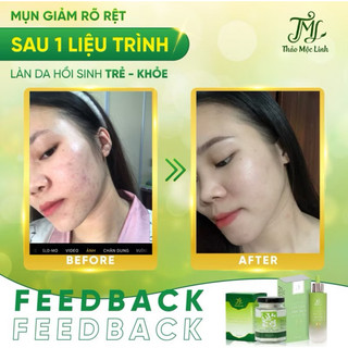 [CHÍNH HÃNG] TINH CHẤT THẢO MỘC LINH.