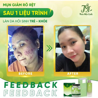 [CHÍNH HÃNG] TINH CHẤT THẢO MỘC LINH.