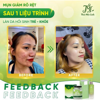[CHÍNH HÃNG] TINH CHẤT THẢO MỘC LINH.