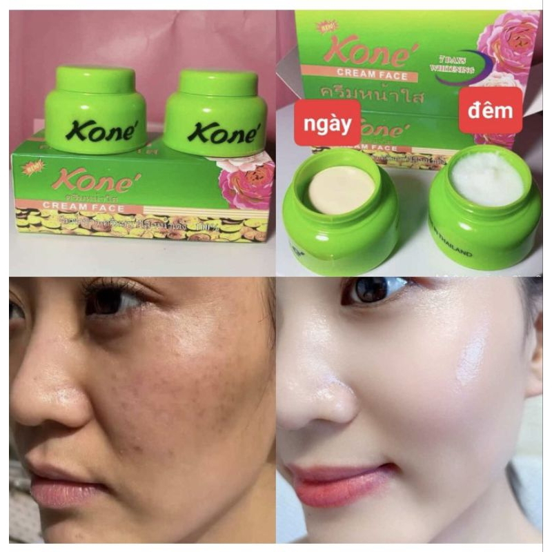 kem bộ kone' thái lan ngày đêm mờ nám sạm làm trắng da