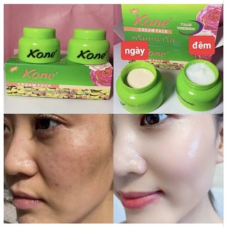 kem bộ kone' thái lan ngày đêm mờ nám sạm làm trắng da