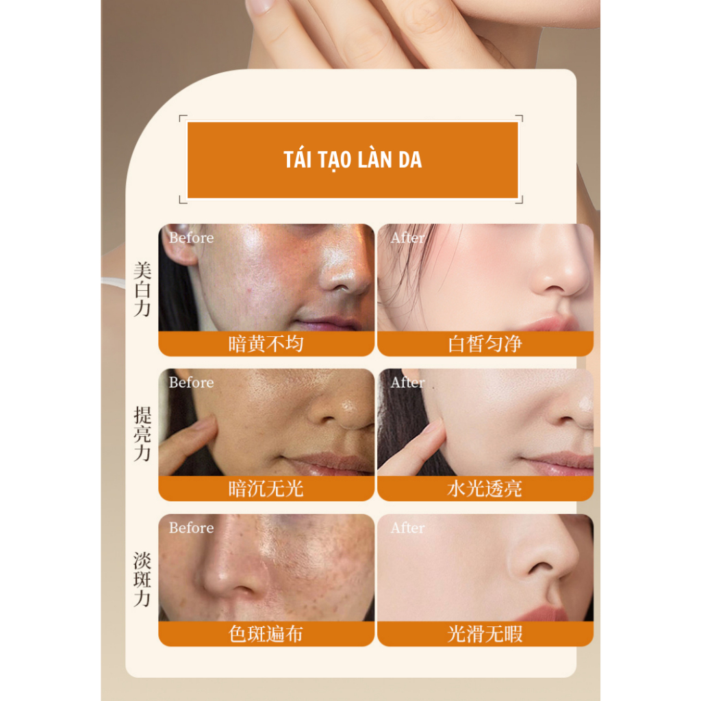 Kem dưỡng trắng sáng da, xóa tàn nhang nám sạm trên da, giúp phục hồi làn da, loại bỏ hắc tố trên da - QUINN BEAUTY