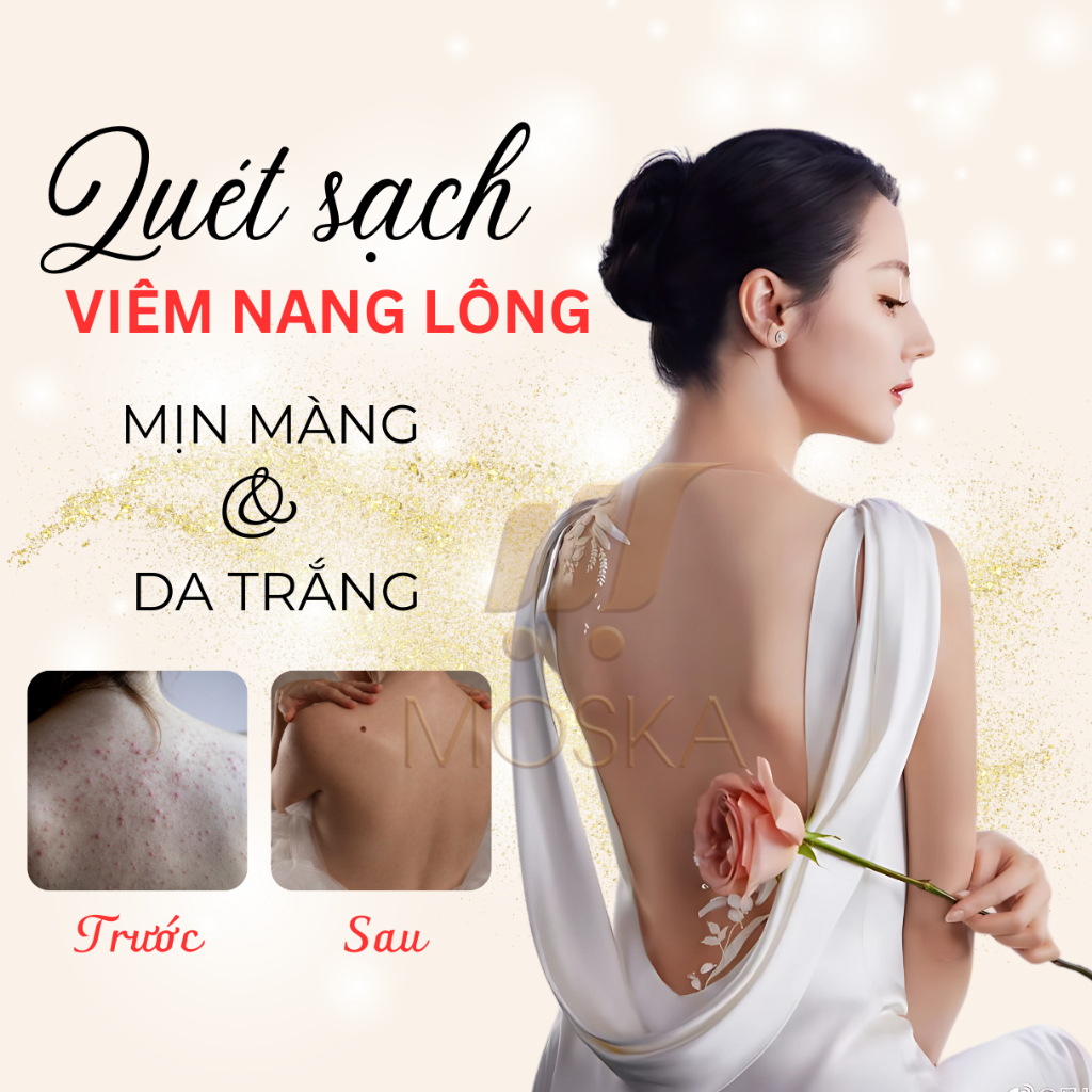 Kem Loại Bỏ Viêm Nang Lông UREA 200ml, Kem Bôi Da Liễu Viêm Chân Lông, Đào Thải Bít Tắt Lỗ Chân Lông, Dày Sừng Nang Lông