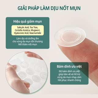 [Sẵn-Nhập khẩu] Miếng Dán Mụn Some By Mi Clear Spot Patch