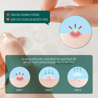 [Sẵn-Nhập khẩu] Miếng Dán Mụn Some By Mi Clear Spot Patch