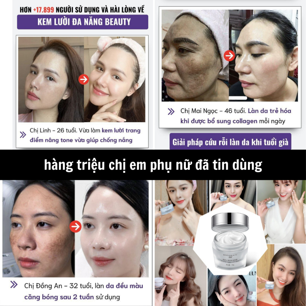 Kem che khuyết điểm HONEY BEAUTY - Kem đa năng che khuyết điểm, dưỡng trắng, xóa nếp nhăn, cải thiện tàn nhang - QUINN