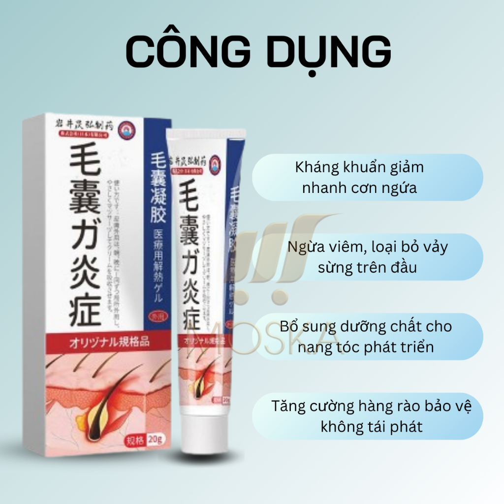Kem viêm nấm ngứa da đầu, viêm nang tiết bã, viêm nang tóc, viêm nang lông IWAI, Sạch Nấm, Mụn Viêm Ngứa sau 7 ngày