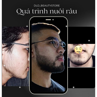 KÍCH MỌC RÂU X3