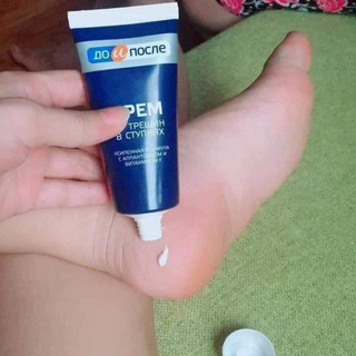 Kem giảm nứt gót chân Kpem Nga