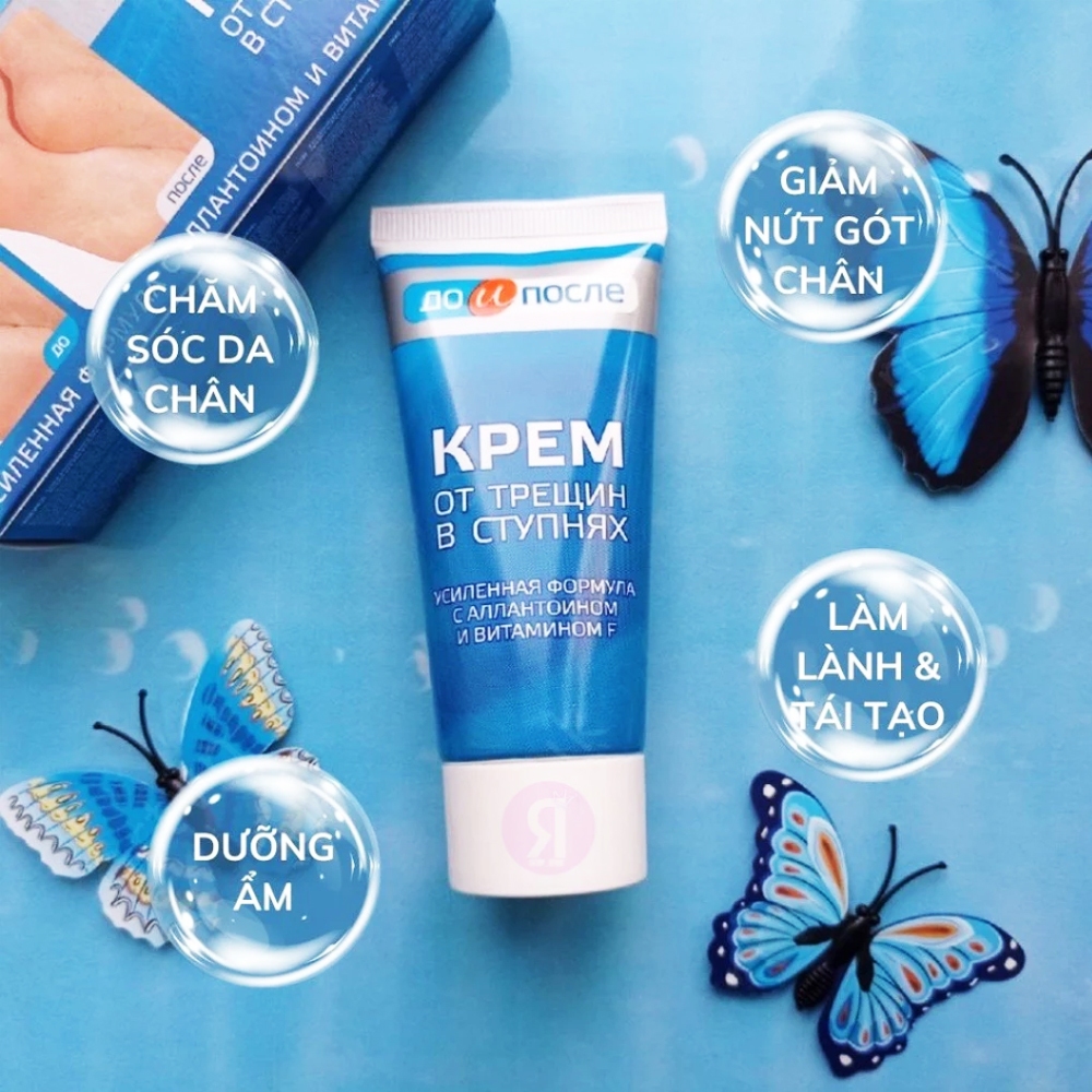 Kem Nứt Gót Chân Kpem Nội Địa Nga 50ml Giúp Tái Tạo Da Gót Chân Và Làm Mềm Da Chân Hiệu Quả