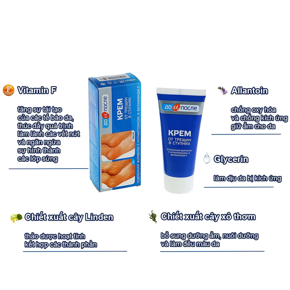 Kem Nứt Gót Chân Kpem Nội Địa Nga 50ml Giúp Tái Tạo Da Gót Chân Và Làm Mềm Da Chân Hiệu Quả