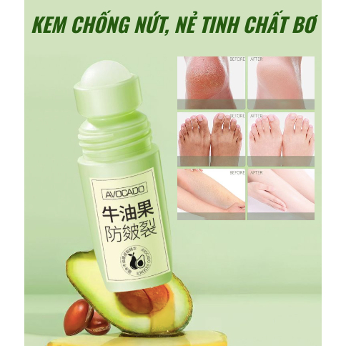 Kem chống, nứt nẻ tinh chất bơ - Kem bơ ngăn ngừa nứt nẻ gót chân, khuỷu tay, đầu gối và ngón tay dưỡng ẩm da mềm mịn