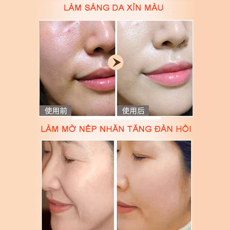 Kem huyết rồng kích trắng da O'MELIN - Kem lười O'MELIN dưỡng ẩm, phục hồi da, mờ nám, tàn nhang, trắng da hiệu quả