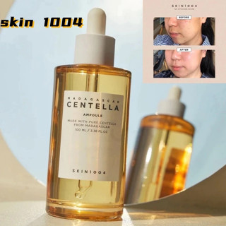 ❤ Serum Centella Rau Má Skin1004 55ml Phục Hồi Da Tinh Chất rau má Skin1004 madagascar chính hãng