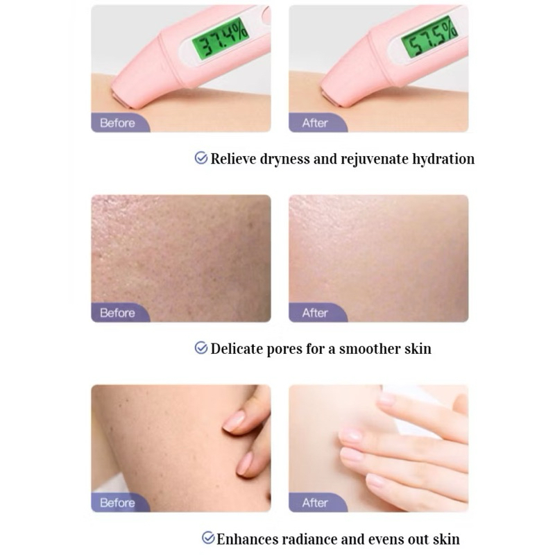 Kem xóa hắc sắc tố thâm sạm UREA - Kem dưỡng trắng da mờ thâm Vitamin E UREA phục hồi, làm sáng và đều màu da hiệu quả