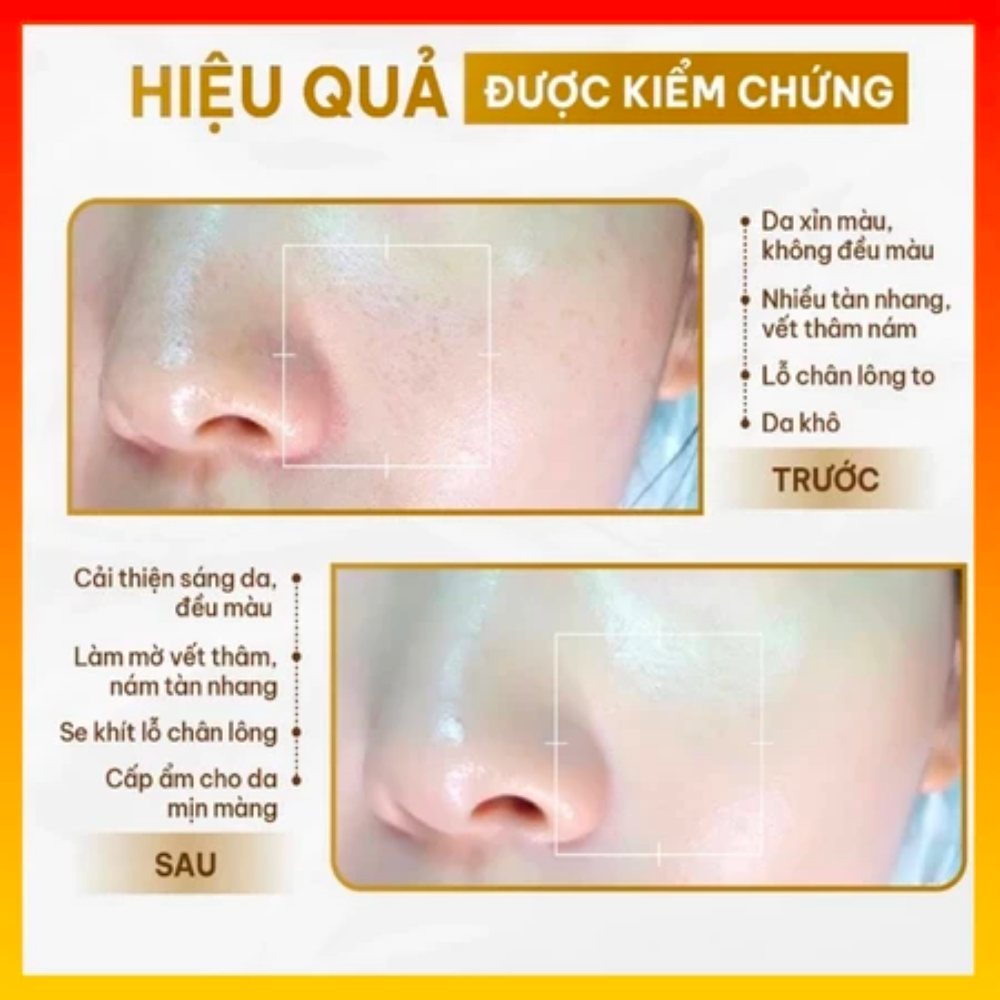 Kem dưỡng da Vitamin C - Kem lười Vitamin C dưỡng trắng da, nâng tông, đều màu, trẻ hóa da, chống nắng SPF 30 PA+++