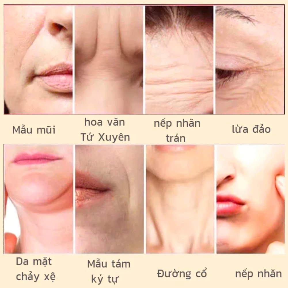 Kem xóa nhăn KHIO NHẬT BẢN - Kem dưỡng ẩm mờ nhăn, trẻ hóa làn da, cải thiện bọng mắt mờ đi vết chân chim