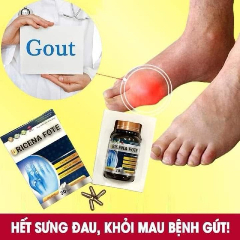 Viên uống Gout URICENA FOTE