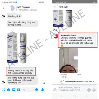 Serum kích mọc tóc loại mạnh Aveline Mỹ hiệu quả,💥HÀNG CAO CẤP CHÍNH HÃNG💥kích tóc mọc nhanh, mọc rậm dày chắc khỏe.