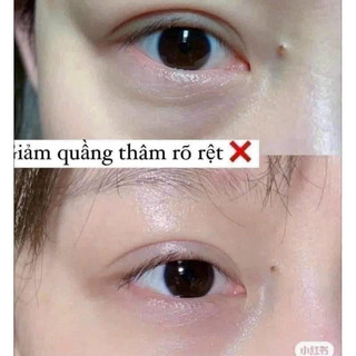 Kem mắt nâu EL 5ml