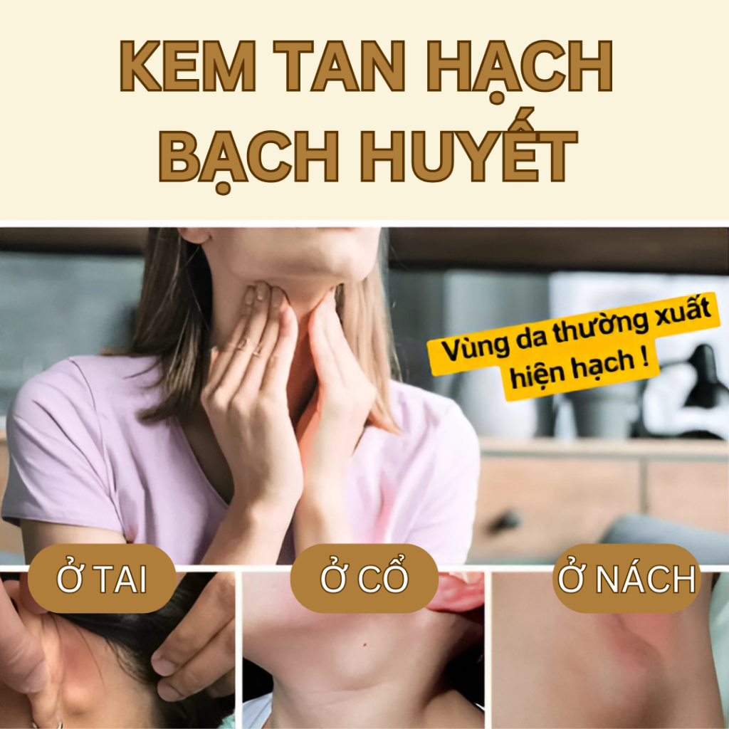 Kem tan hạch bạch huyết SHIXENDO Nhật Bản Giảm U Hạch, Giảm Sưng, Giảm Đau