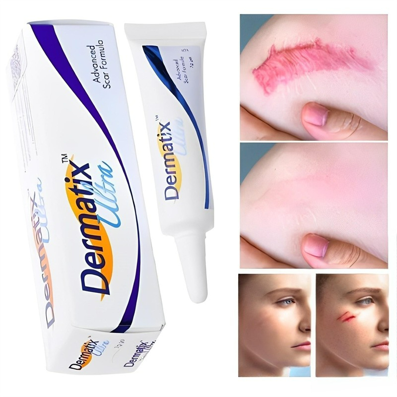 Dermatix Ultra Gel Kem Làm Mờ Sẹo Thâm, sẹo15g